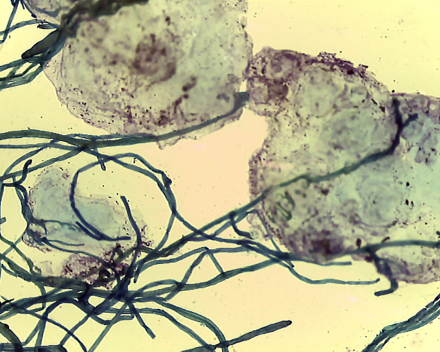 TerraCottem’s effect on biomass production in vermiculite and perlite tomato seedbeds and on the WRC of these seedbeds